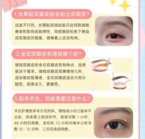 双眼皮 双眼皮