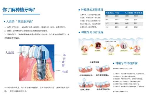 牙齿种植 牙齿种植