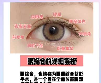 双眼皮 双眼皮