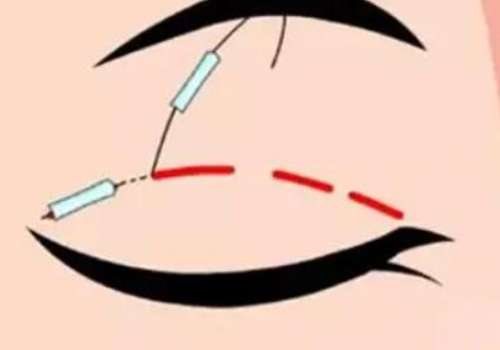 信阳双眼皮医院排名来袭！信阳市中心医院、固始县妇幼保健院院等详情公开！