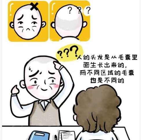 植发 植发