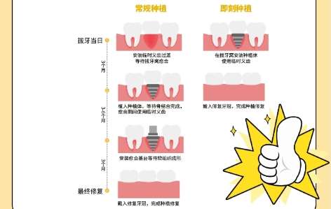 牙齿种植 牙齿种植