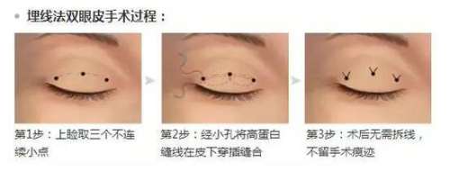u=2605009249,2285402464&fm=26&gp=0.jpg