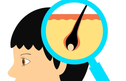 哈尔滨医大一院植发，真实流程和效果对比